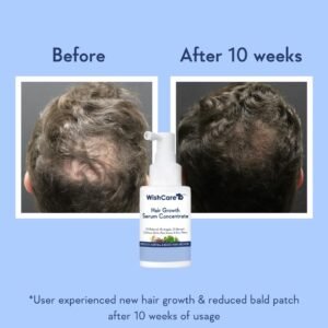 WishCare Hair Growth Serum Price in BD