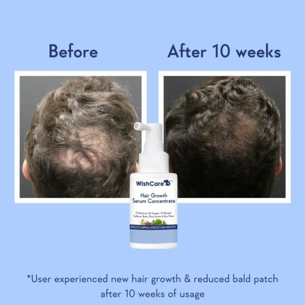 WishCare Hair Growth Serum Price in BD