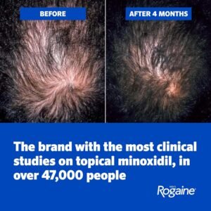 Rogaine Hair Regrowth & Thickening Combo bd