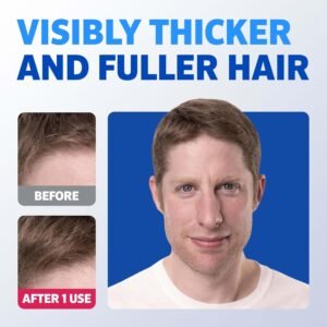 Rogaine Hair Regrowth & Thickening Combo