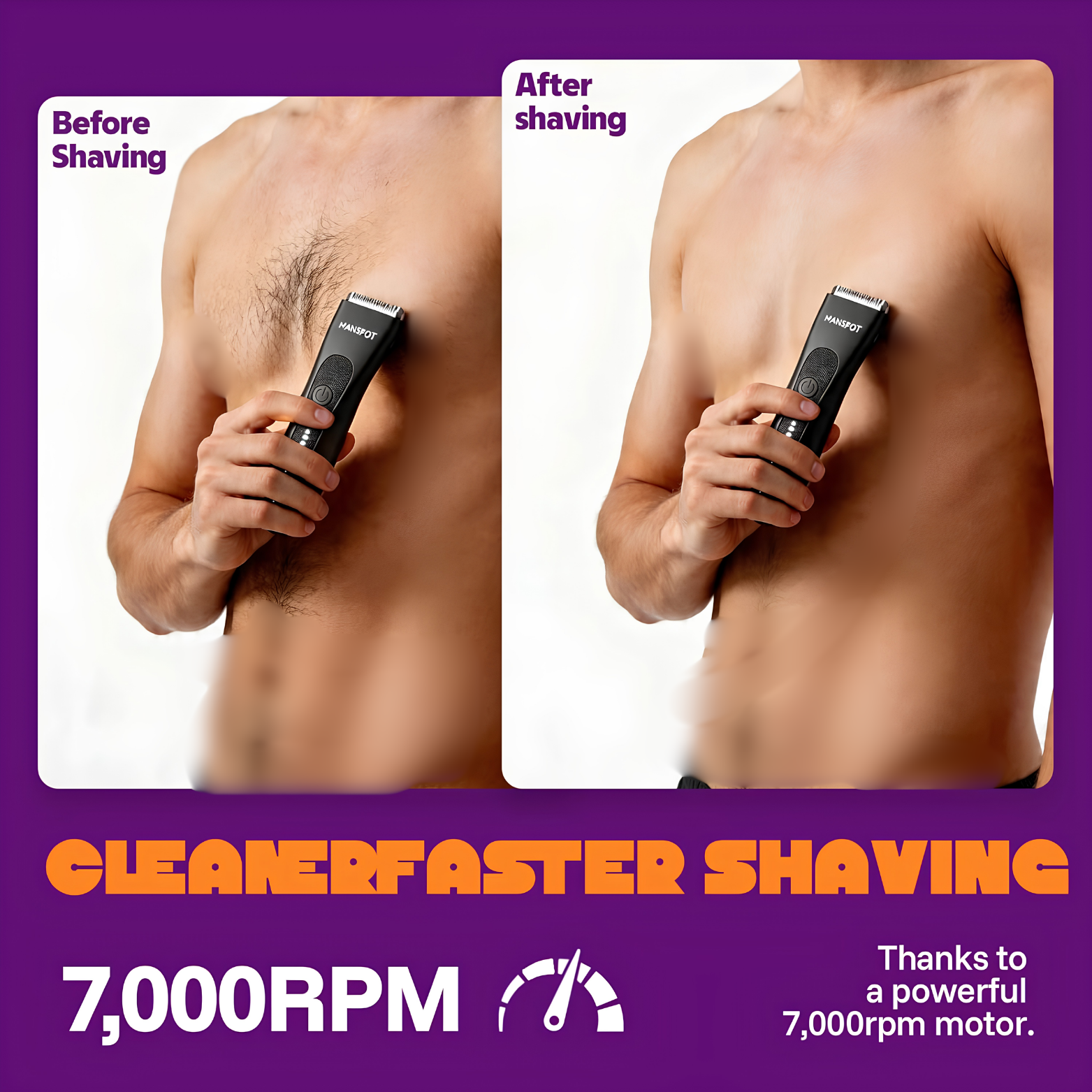 MANSPOT Manscape Groin and Body Hair Trimmer kit with 4 guards and charging cable